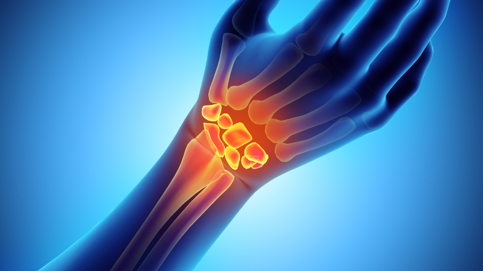 hand and wrist pain | Klamath Orthopedic Clinic and Sports Medicine